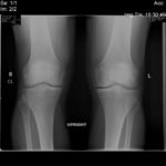 After Treatment Image